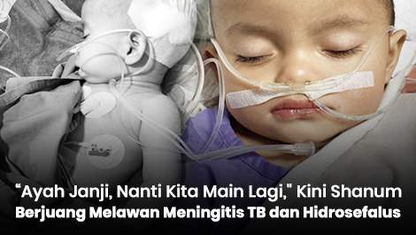 “Ayah Janji, Nanti Kita Main Lagi," Kini Shanum Berjuang Melawan Meningitis TB dan Hidrosefalus