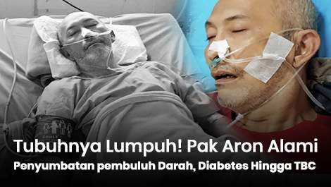 Tubuhnya Lumpuh! Pak Aron Alami Penyumbatan pembuluh Darah dan Diabetes