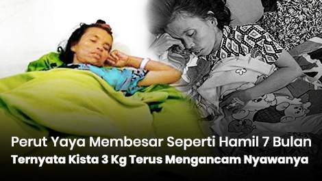 Perut Yaya Membesar Seperti Hamil 7 Bulan, Ternyata Kista 3 Kg Terus Mengancam Nyawanya