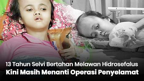 13 Tahun Selvi Bertahan Melawan Hidrosefalus, Kini Masih Menanti Operasi Penyelamat