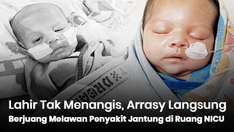 Lahir Tak Menangis, Arrasya Langsung Berjuang Melawan Penyakit Jantung di Ruang NICU