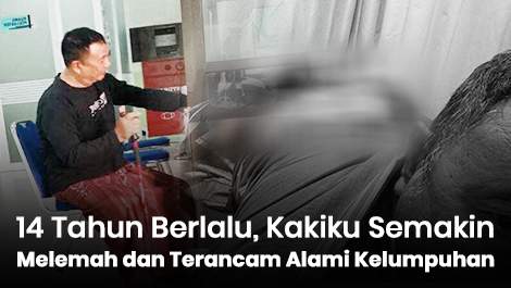 14 Tahun Berlalu, Kakiku Semakin Lemah dan Terancam Alami Kelumpuhan