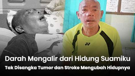 Darah Mengalir dari Hidung Pak Suandi, Tak Disangka Tumor dan Stroke Mengubah Hidupnya