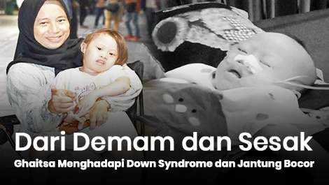 Dari Demam dan Sesak, Ghaitsa Harus Menghadapi Down Syndrome dan Jantung Bocor