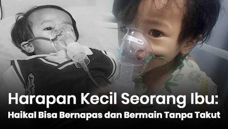 Harapan Kecil Seorang Ibu: Haikal Bisa Bernapas dan Bermain Tanpa Takut Sesak