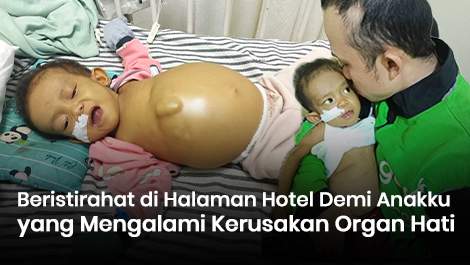 Beristirahat di Halaman Hotel Demi Anakku yang Mengalami Kerusakan Organ Hati