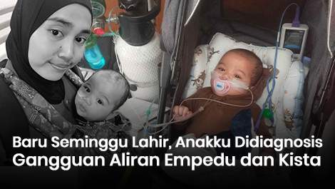 Baru Seminggu Lahir, Anakku Didiagnosis Gangguan Aliran Empedu dan Kista