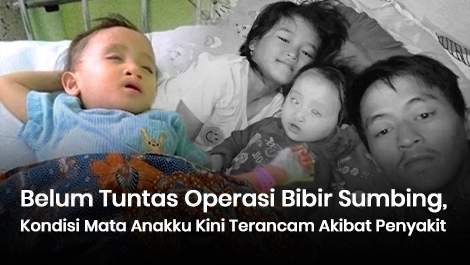 Belum Tuntas Operasi Bibir Sumbing, Kondisi Mata Anakku Kini Terancam Akibat Penyakit