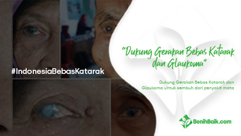 Dukung Gerakan Bebas Katarak dan Glaukoma