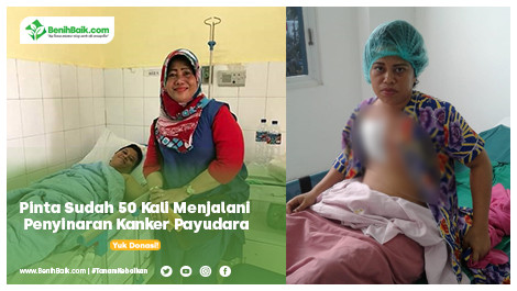Pinta Sudah 50 Kali Menjalani Penyinaran Kanker Payudara
