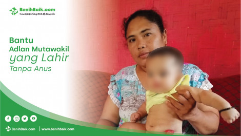Bantu Adlan Mutawakil Yang Lahir Tanpa Anus