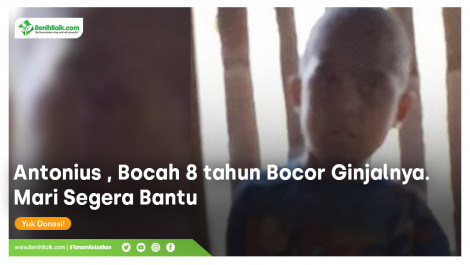Bantu Pengobatan Antonius, Bocah yang Ginjalnya Bocor