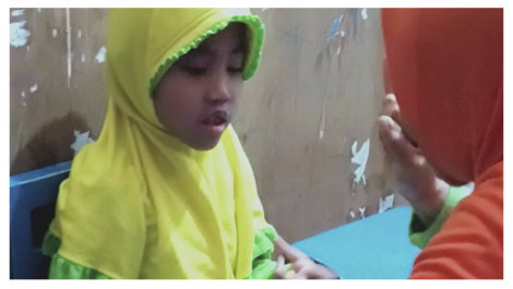 Fadilah Berjuang Melawan Lumpuh Otak