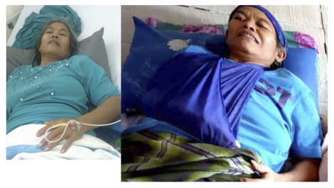 Bantu Terapi Stroke Asiyah