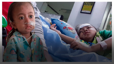 Sejak Usia 3 Tahun, Devi Menderita Lupus