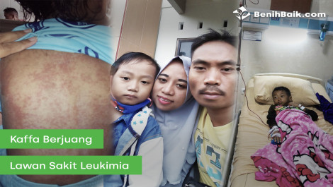 Kaffa Sedang Berjuang Melawan Leukemia