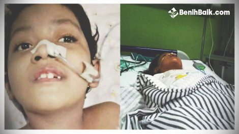 Ringankan Cobaan Naya Yang Terkena Meningitis Dan Cerebral Palsy