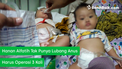 Hanan Alfatih Tak Punya Lubang Anus, Harus Operasi 3 Kali