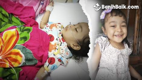Anakku Keinarra Menderita Kelainan Langka Cranial Nerve Palsy Susp Autoimun