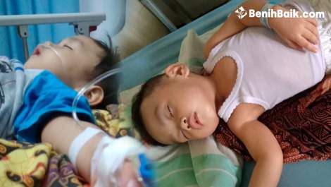 Ello Harus Bedah Saraf Akibat Epilepsi dan Cerebral Palsy, Yuk Kita Bantu!