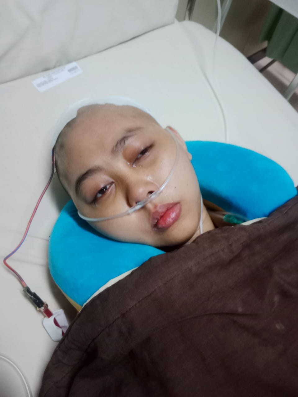 Dari Kesakitan Menuju Kekuatan, Perjalanan Nafa Bertahan dari Kanker Otak